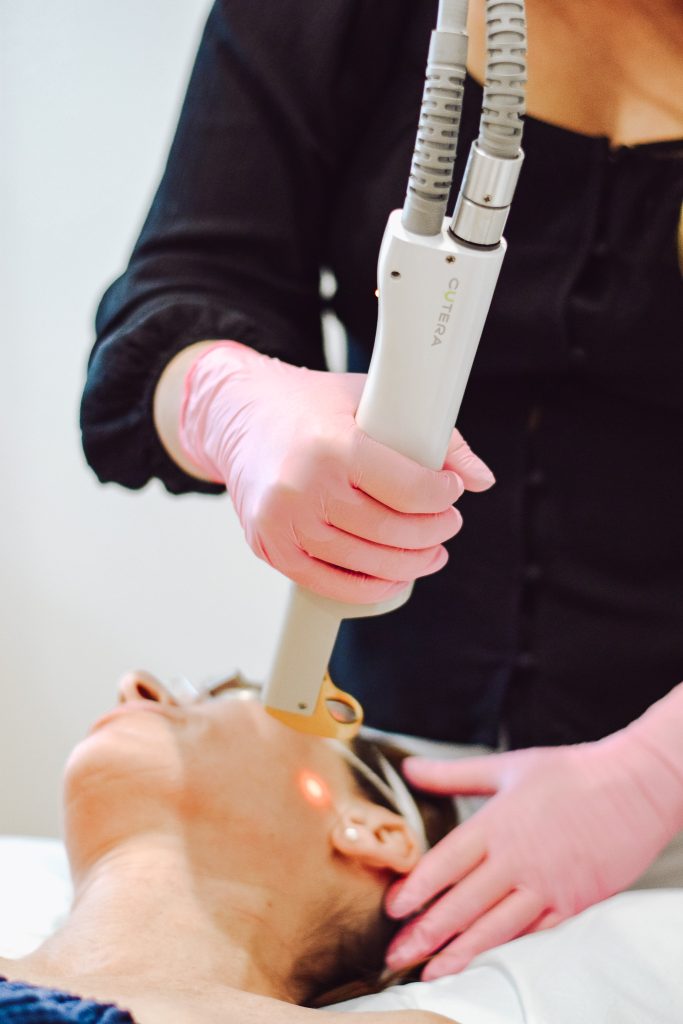 Laser Peel
