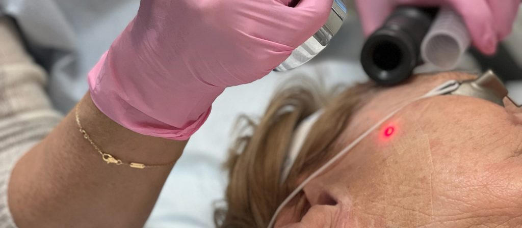laser scar removal banner