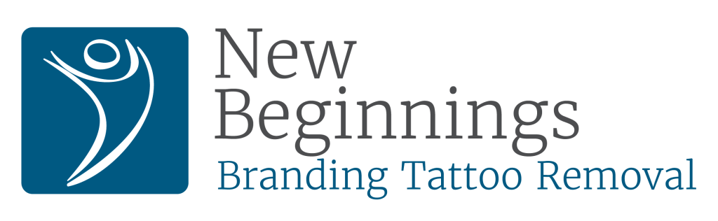 New Beginnings Tattoo Removal