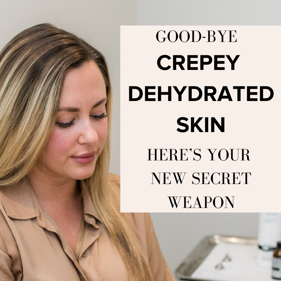 Radiance Medical Spa Skincare Expert Giving her Winter Skincare Tips