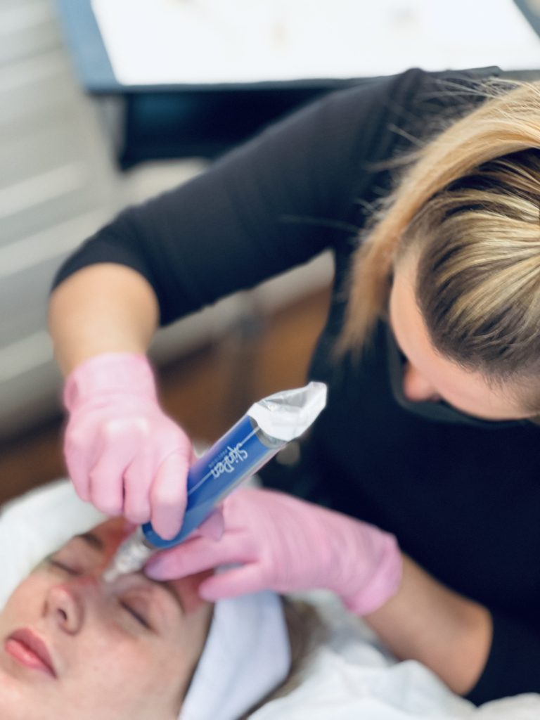 woman receiving microneedling treatment on face