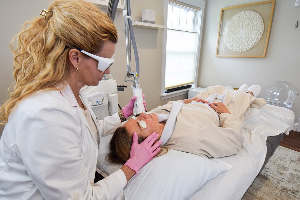 Halo Laser Skin Treatment for fine lines and wrinkles