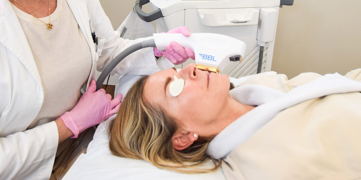 Rosacea Treatment in Williston VT